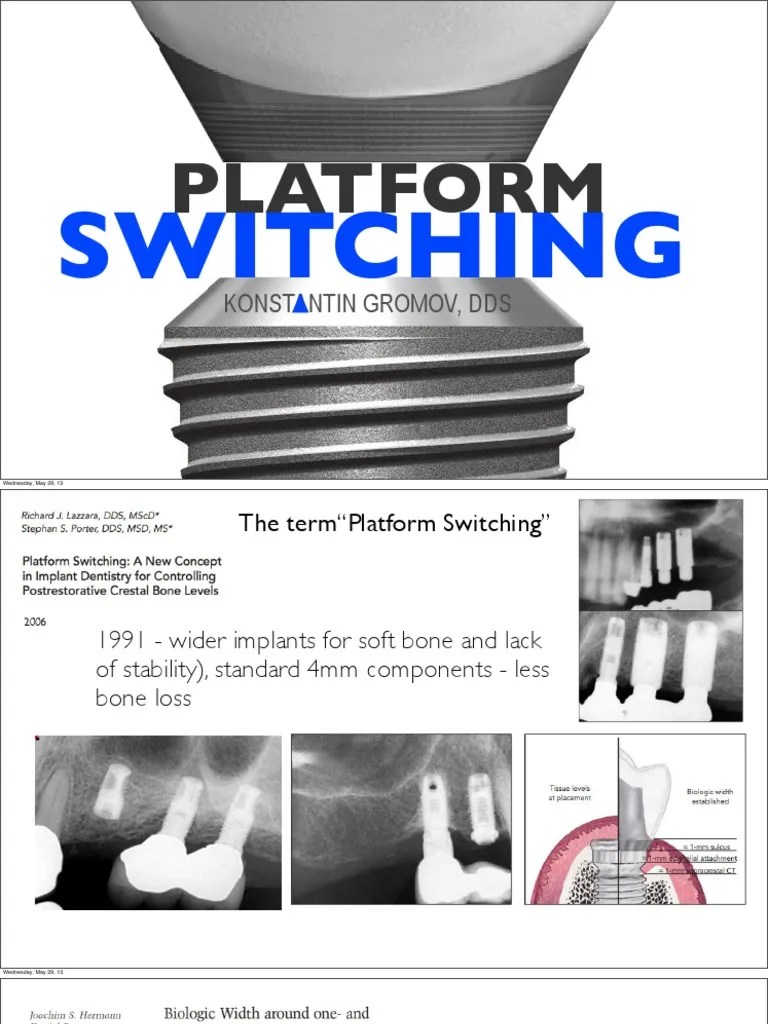 Platform Switching, Gromov Dental Implant Health Sciences