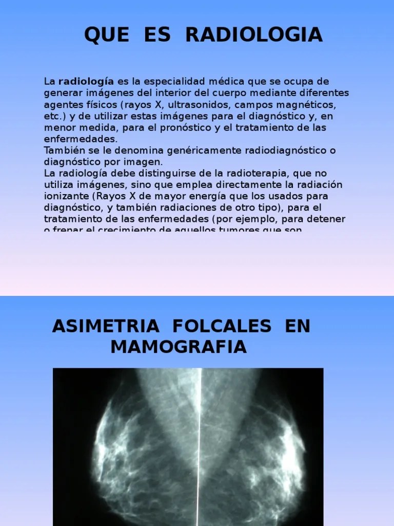 QUE ES RADIOLOGIA Radiología Ct Scan