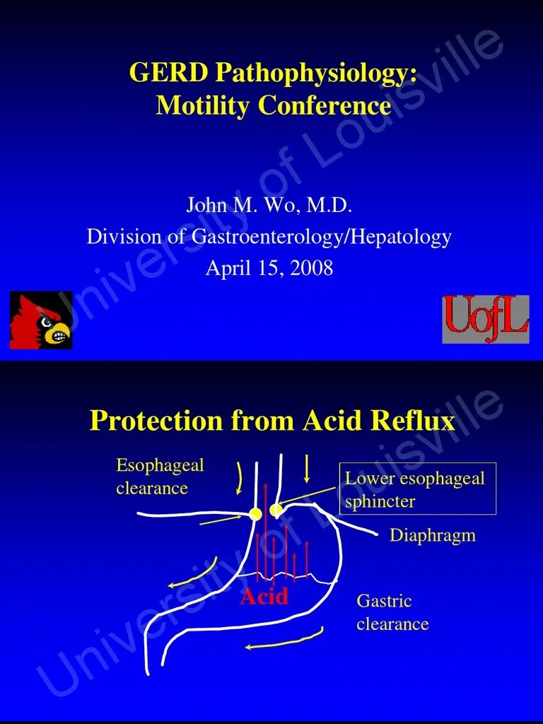 GERD Pathophysiology Heartburn Gastroesophageal Reflux Disease