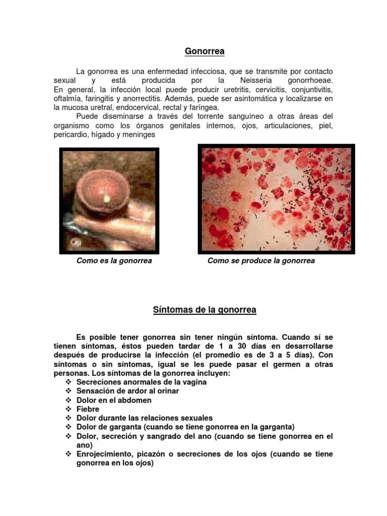 Gonorrea Infección transmitida sexualmente Ciencias de la Salud