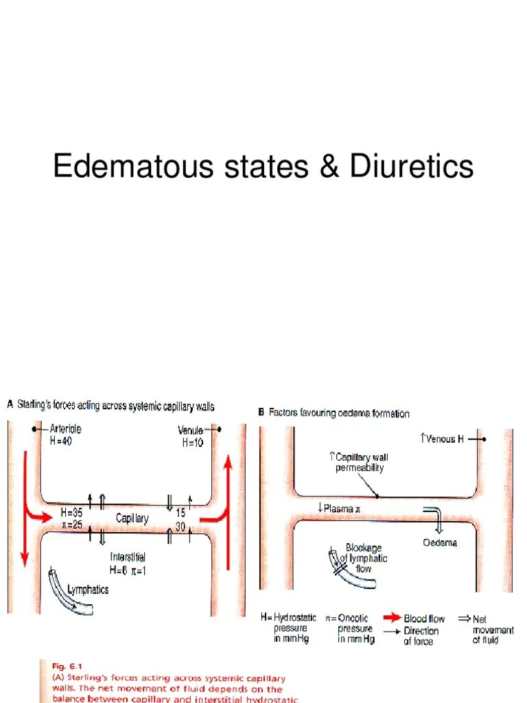 Edematous states & Diuretics.ppt Edema Heart Failure