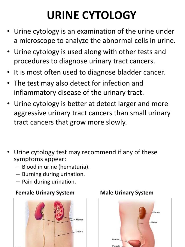 Urine Collection in Cytology Urinary Tract Infection Cytopathology