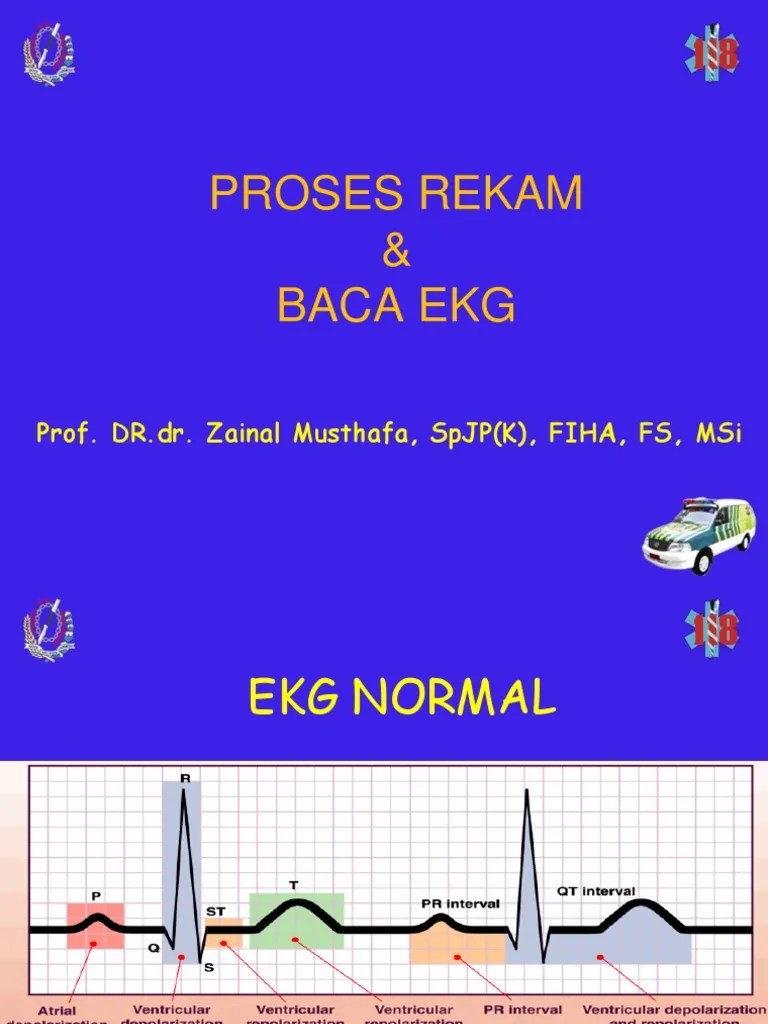 EKG normal btcls.ppt