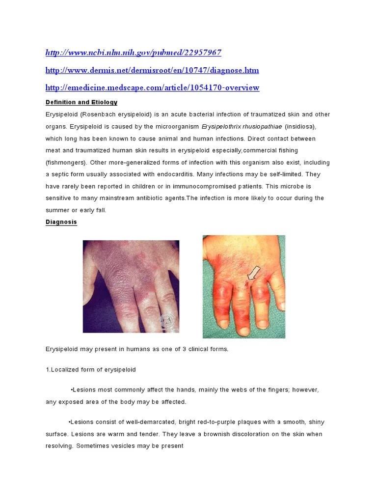 Erysipeloid Infection Public Health