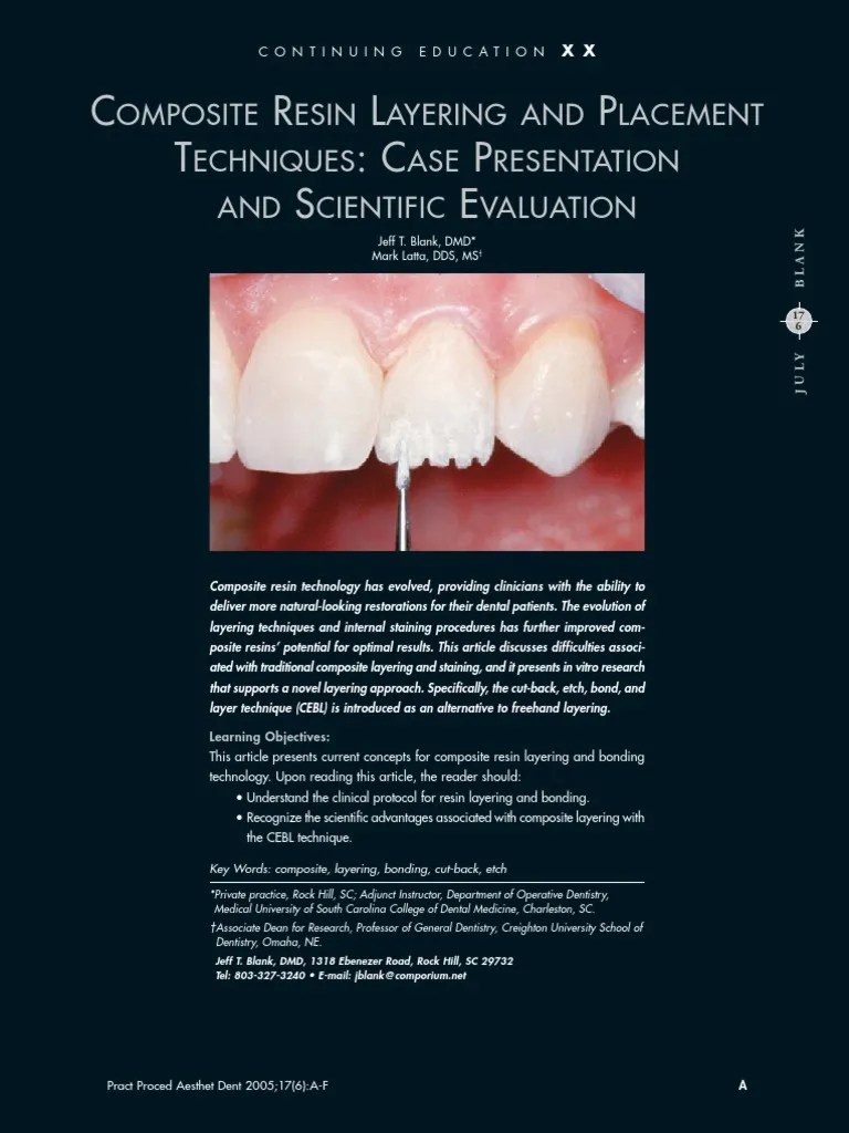 Composite Resin Layering and Placement Techniques Dental Composite