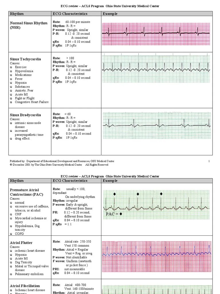 EKG Examples Electrocardiography Cardiovascular System