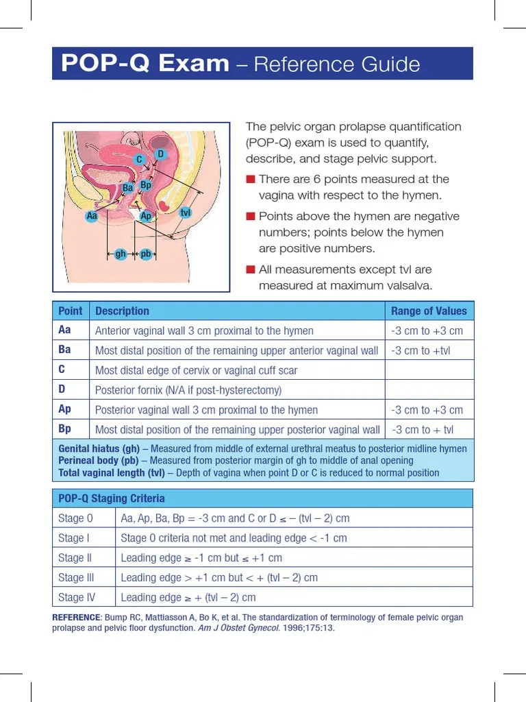 POPQ Exam Reference Guide PDF