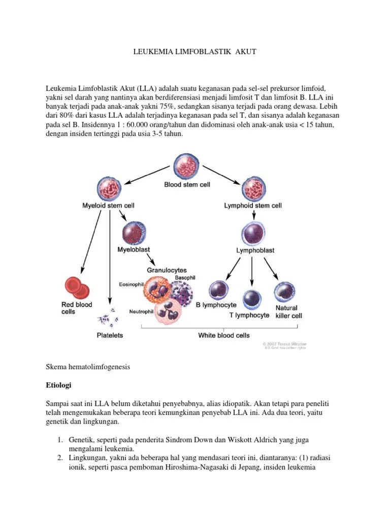 Leukemia Limfoblastik Akut