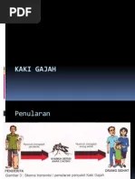 Otitis Eksterna Maligna