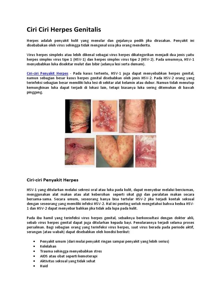 Ciri Ciri Herpes Genitalis | PDF