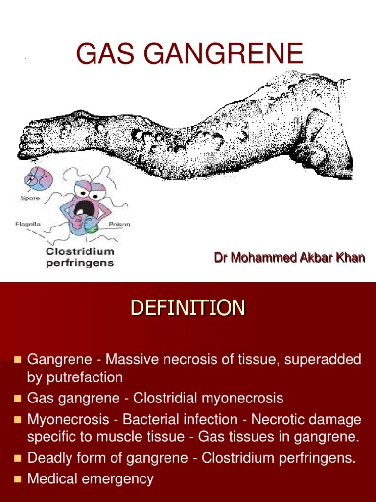 Gas Gangrene DR Akbar PDF Clinical Medicine Medicine