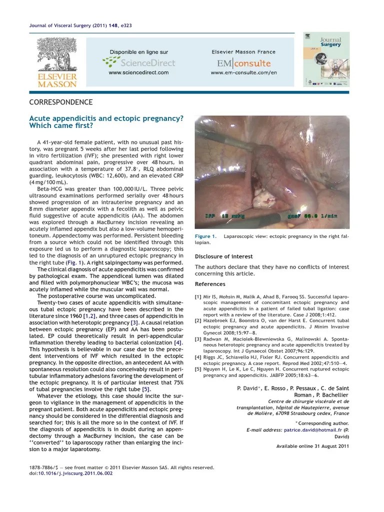 Acute Appendicitis and Ectopic Pregnancy Which Came First Women's