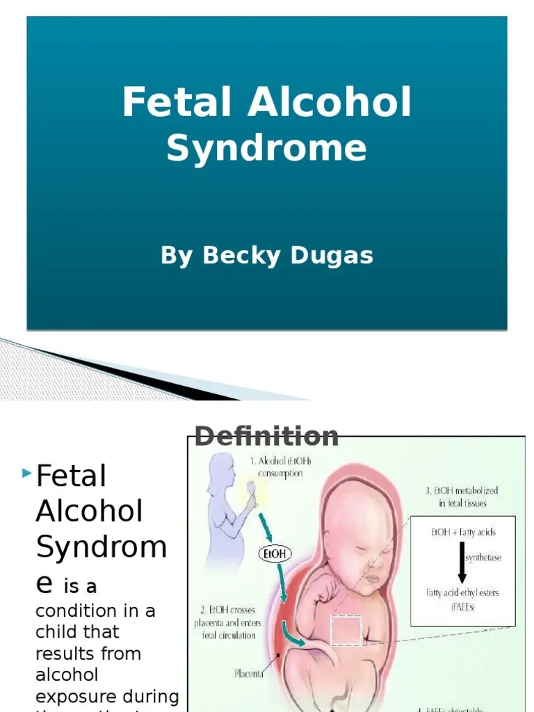 Fetal Alcohol Syndrome PDF Alcoholism Child Development