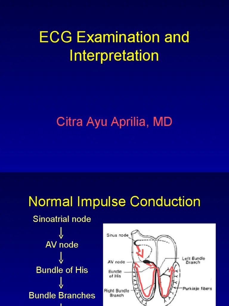 Pemasangan Dan Interpretasi EKG Electrocardiography Cardiac Arrhythmia