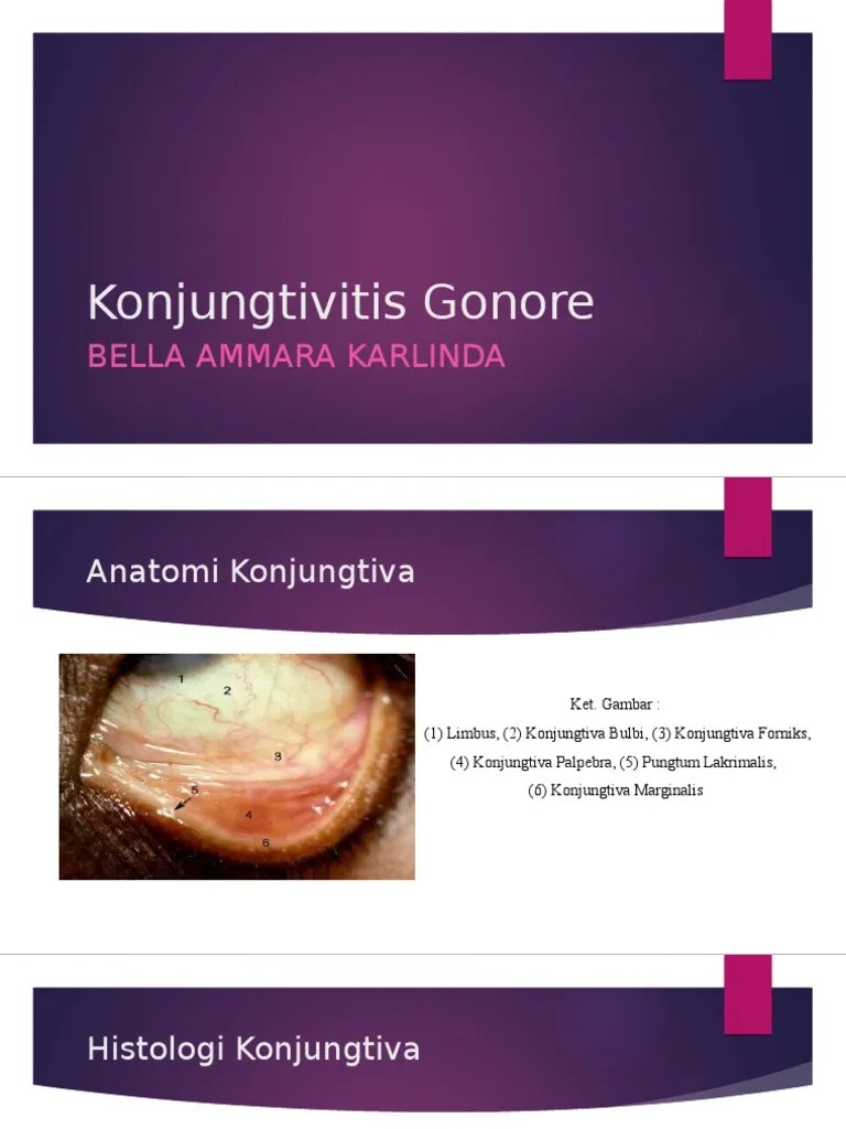 Konjungtivitis Gonore PDF