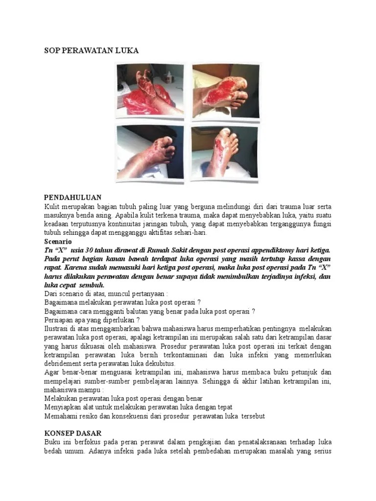 SOP Perawatan Luka
