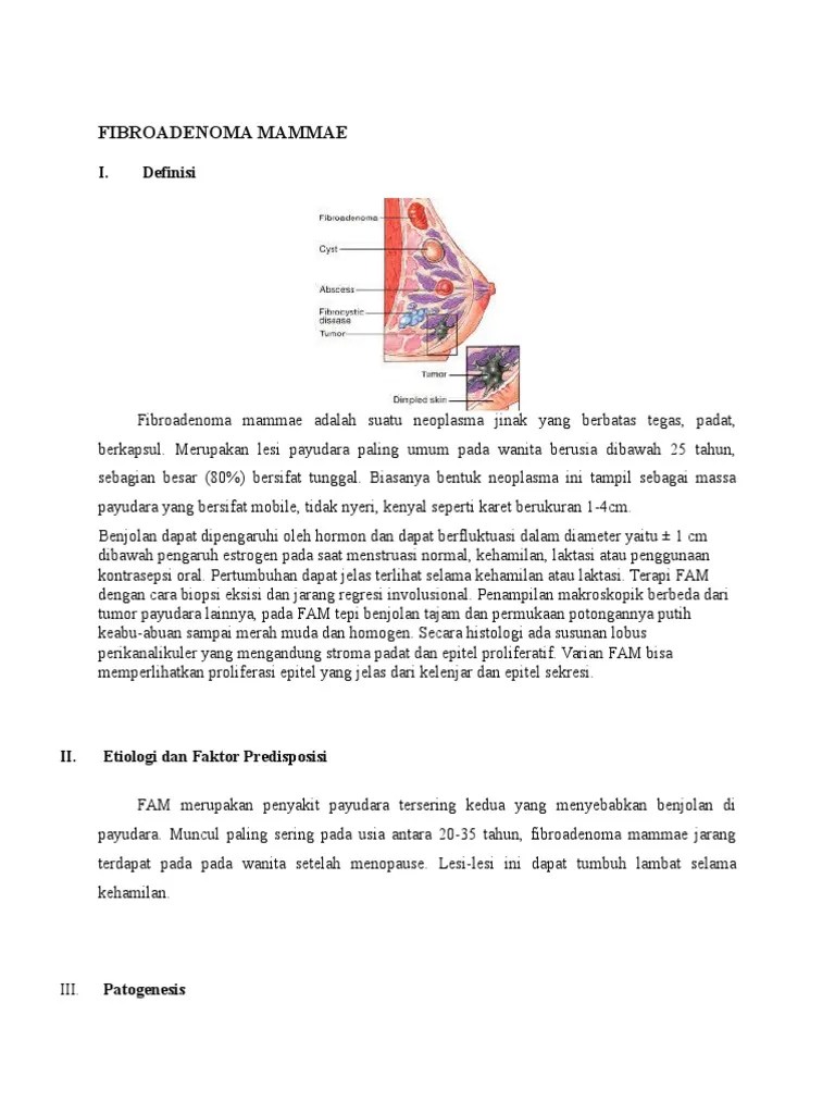 Lp Fibroadenoma Mammae
