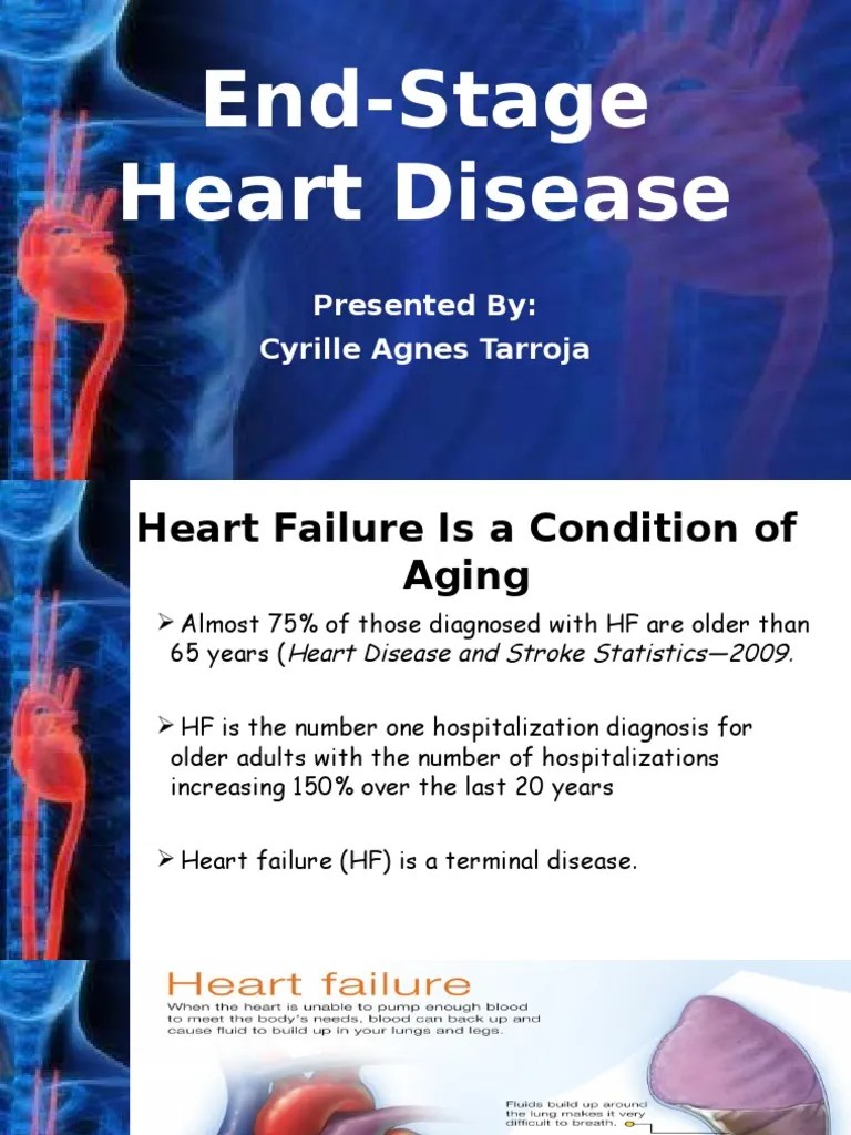 EndStage Heart Disease Heart Failure Palliative Care