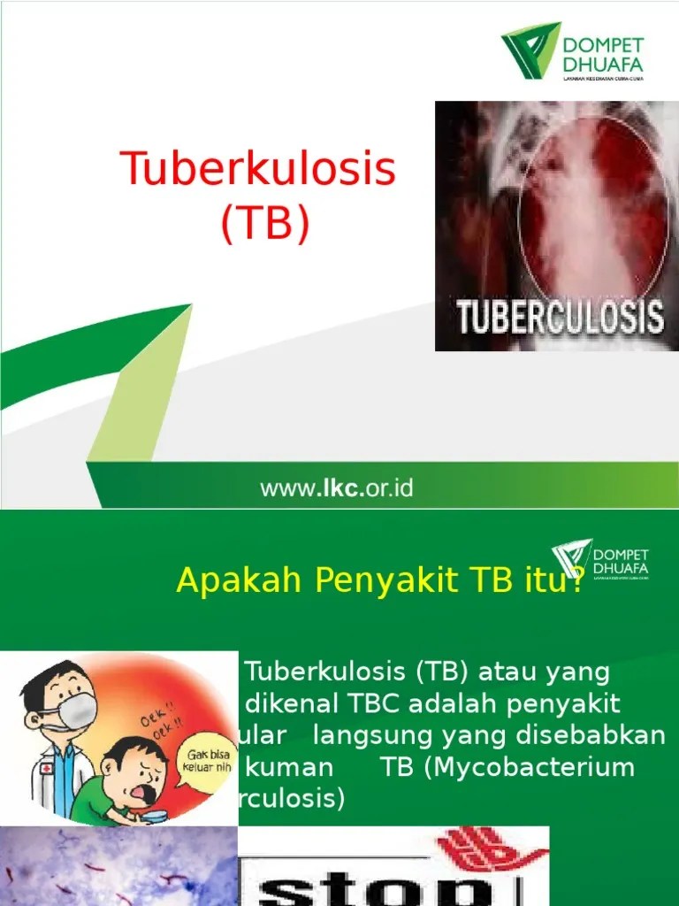 Materi Penyuluhan TB