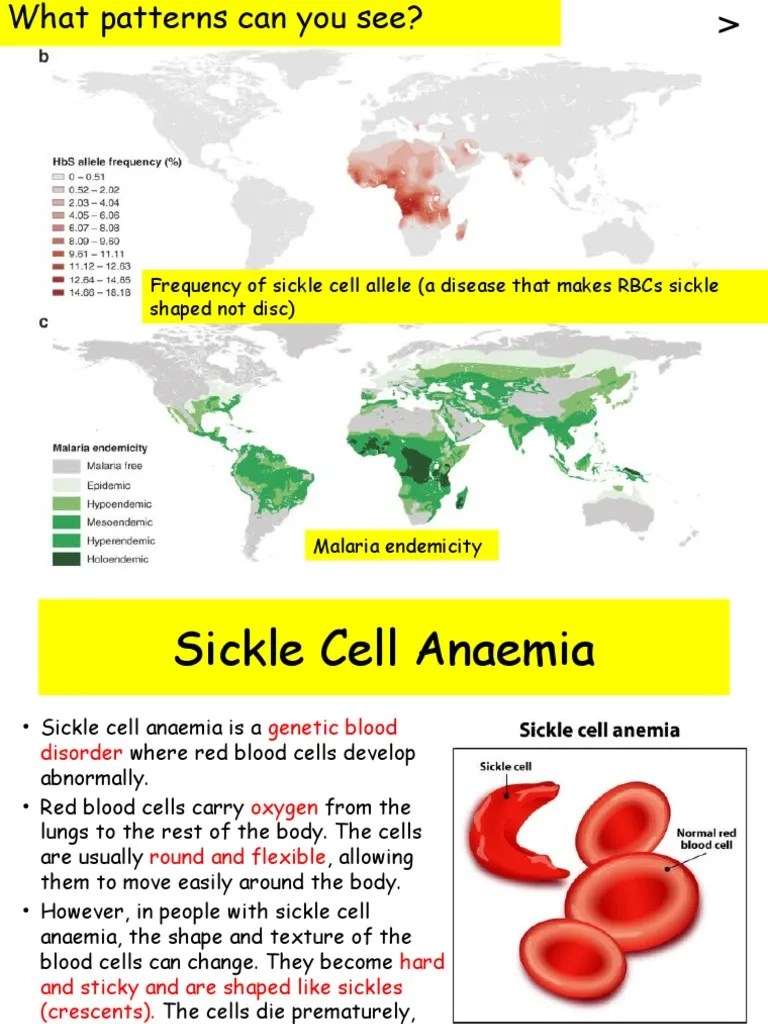 Mutation and Sickle Cell PDF Sickle Cell Disease Mutation