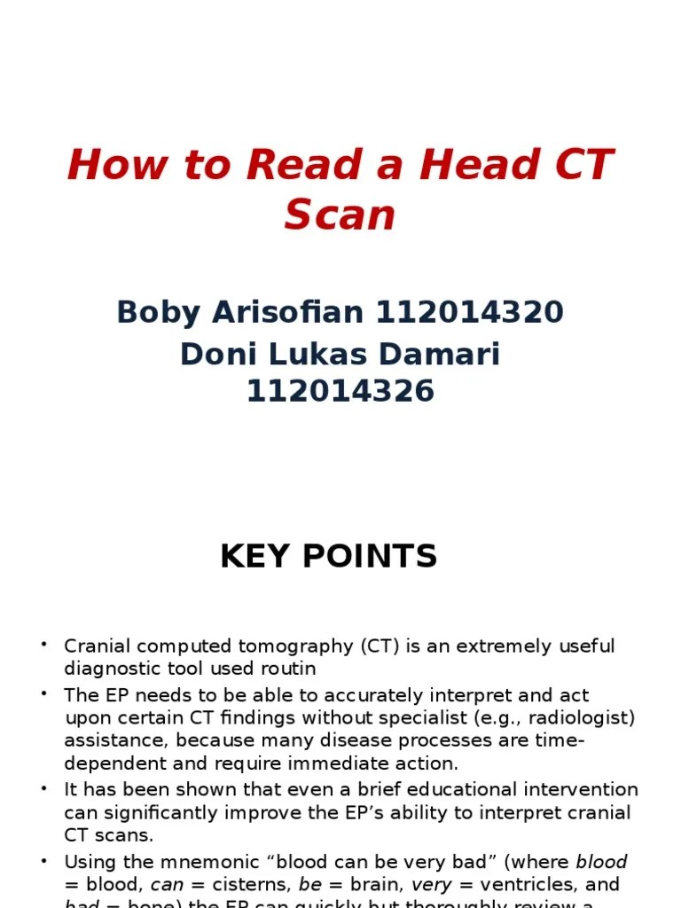 How to Read a Head CT Scan Ct Scan Neurology
