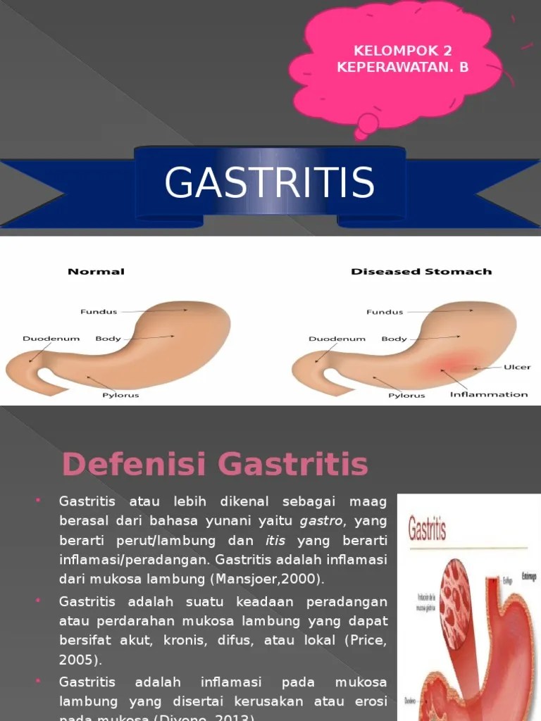 Gastritis | PDF