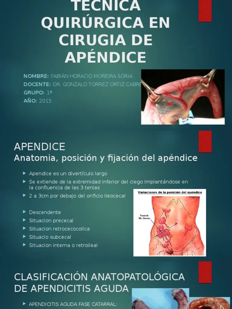 Técnica Quirúrgica en Cirugia de Apéndice PDF Cirugía