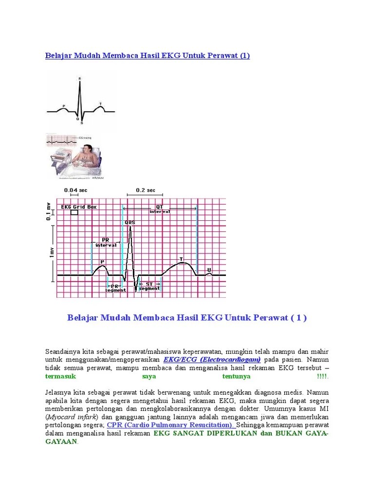 Belajar Mudah Membaca Hasil EKG Untuk Perawat