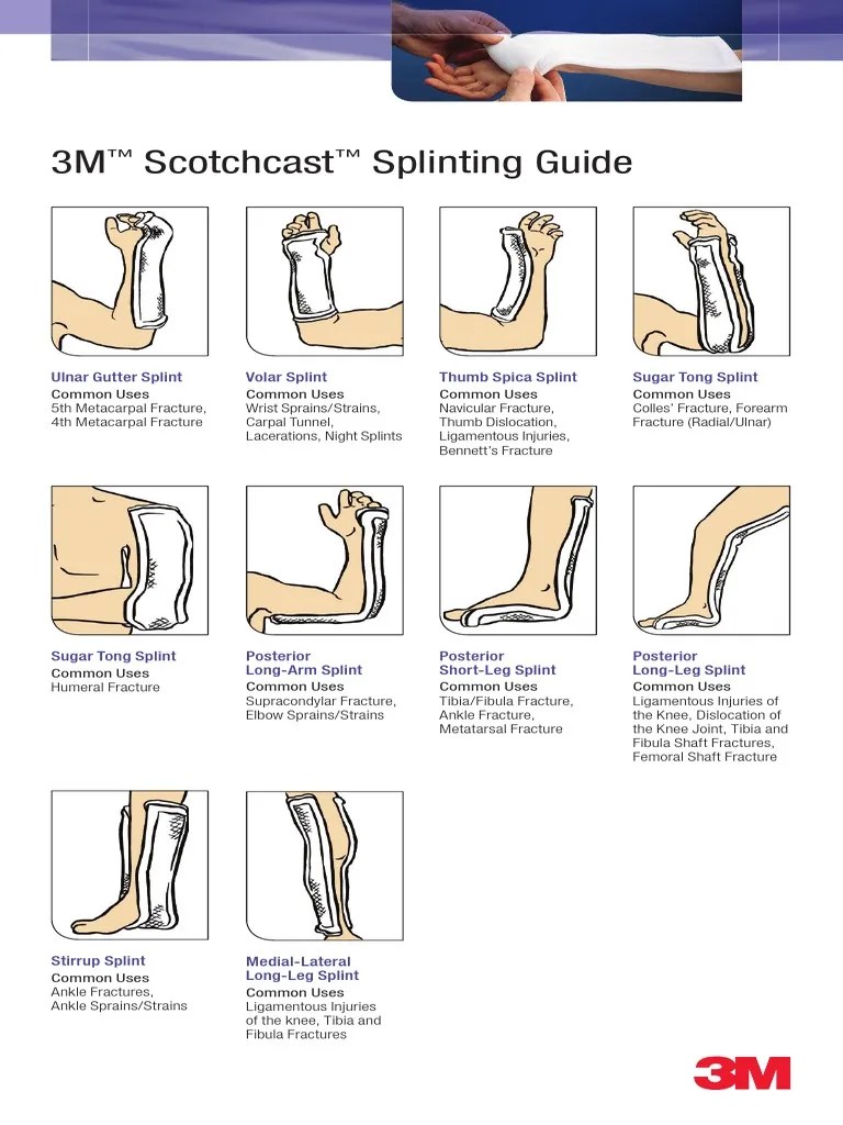 BA82 Scotchcast Splinting Pocket Guide v1 3 Final