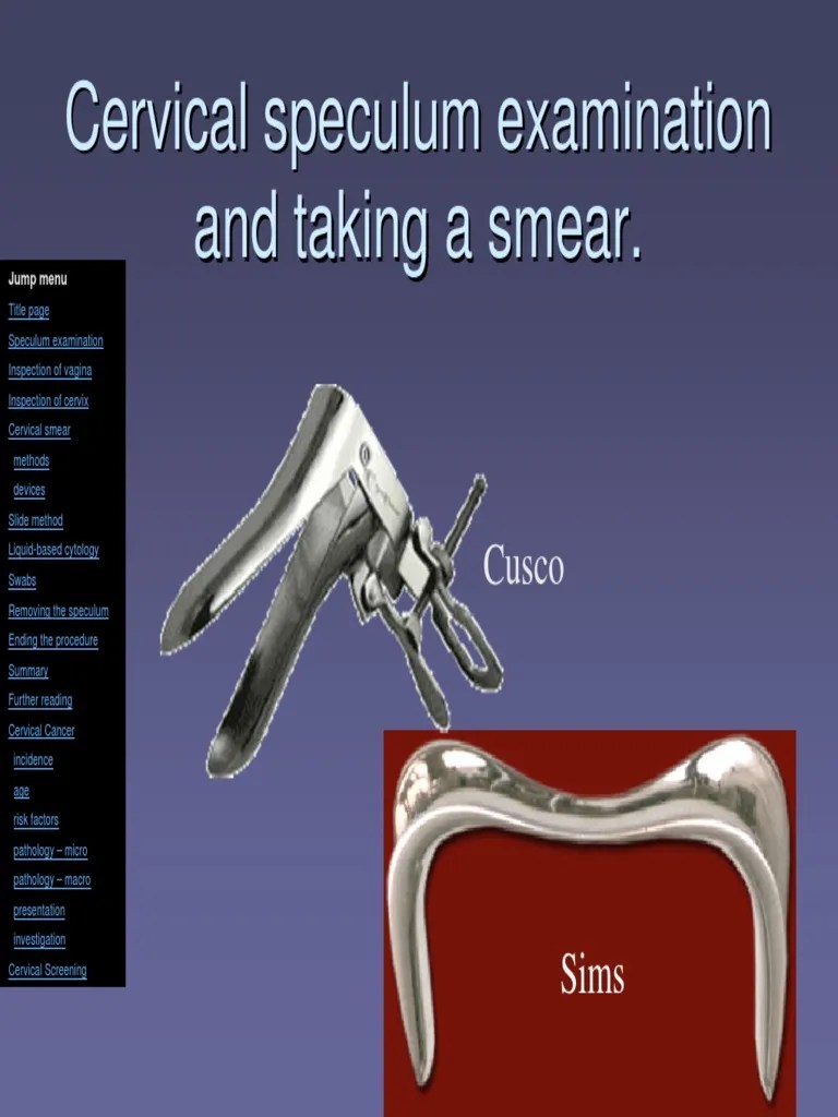 Cervical Speculum Examination Cervical Cancer Cytopathology
