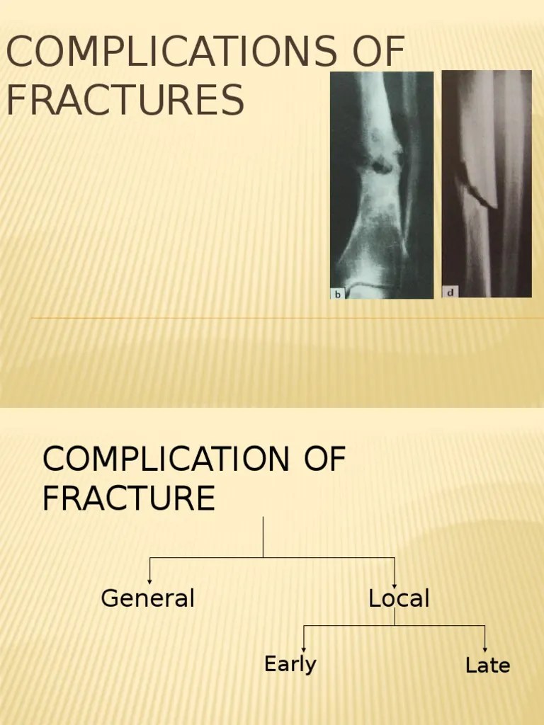 Complications of Fractures Ischemia Wound