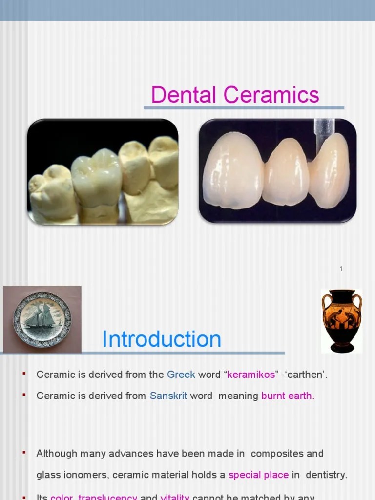 6. DENTAL CERAMICS.PPT Glasses Metals