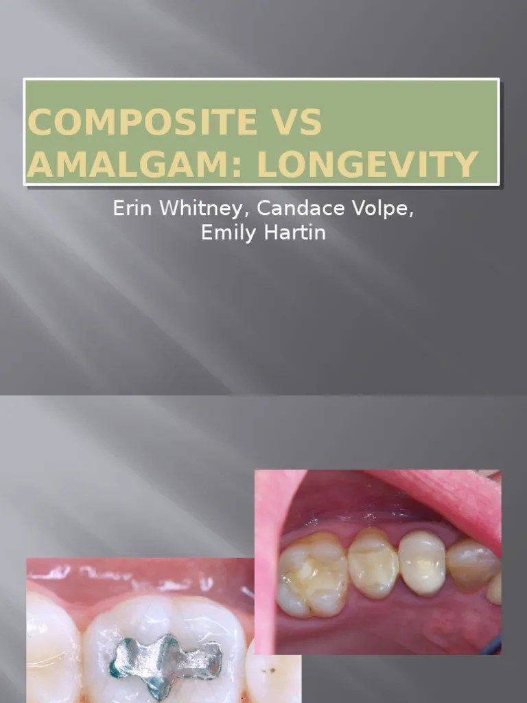 composite vs amalgam powerpoint Dental Composite Dentistry