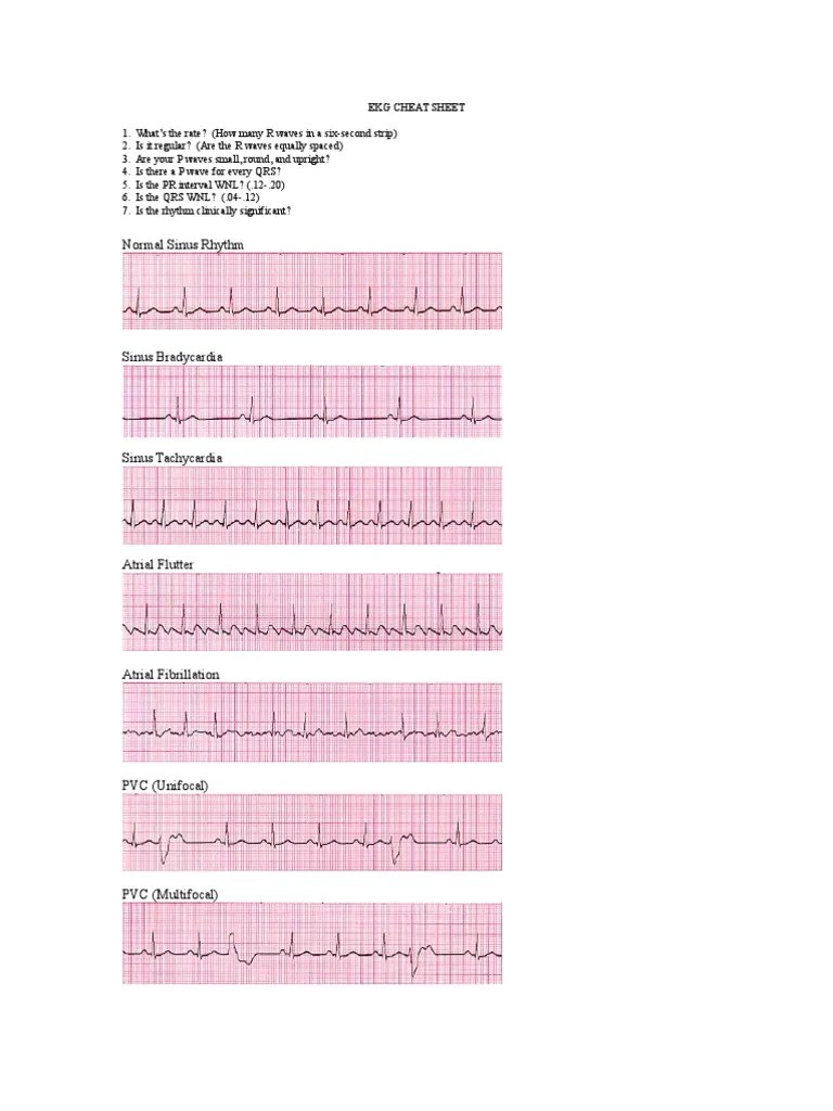 Printable Ekg Cheat Sheet Printable Ekg Cheat Sheet
