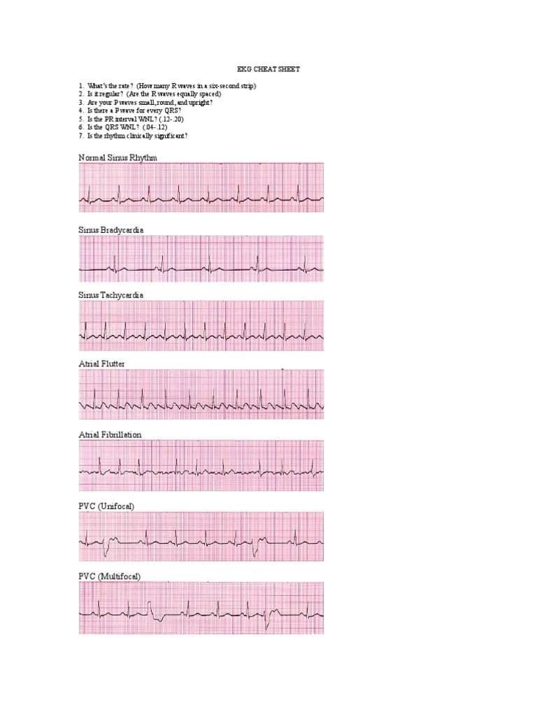 Ekg Cheat Sheet