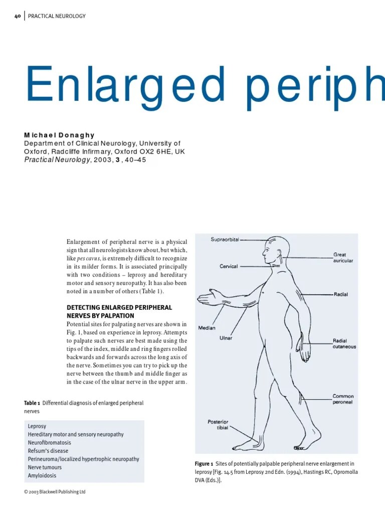Enlarged Peripheral Nerves On Leprosy Peripheral Neuropathy Leprosy