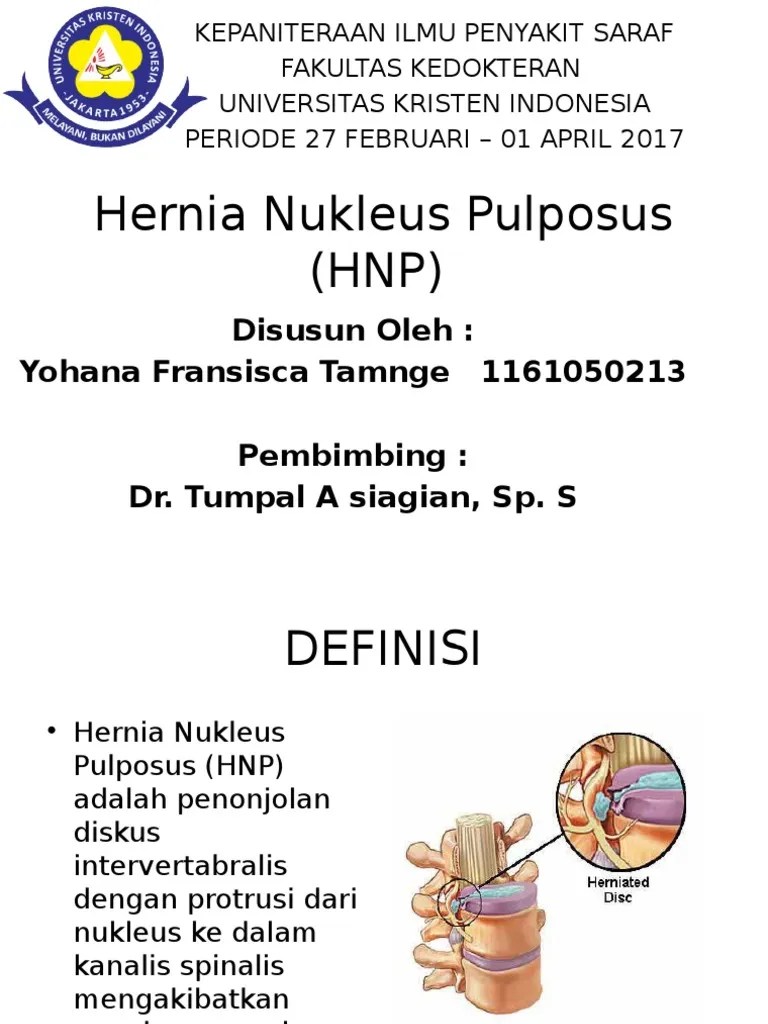 Hernia Nukleus Pulposus (HNP) PPT.pptx