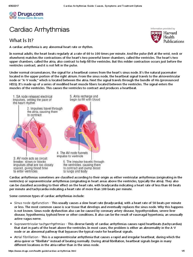 Cardiac Arrhythmias Guide_ Causes, Symptoms and Treatment Options