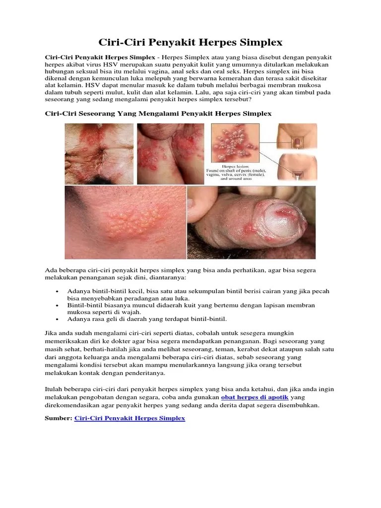 Ciri-Ciri Penyakit Herpes Simplex | PDF