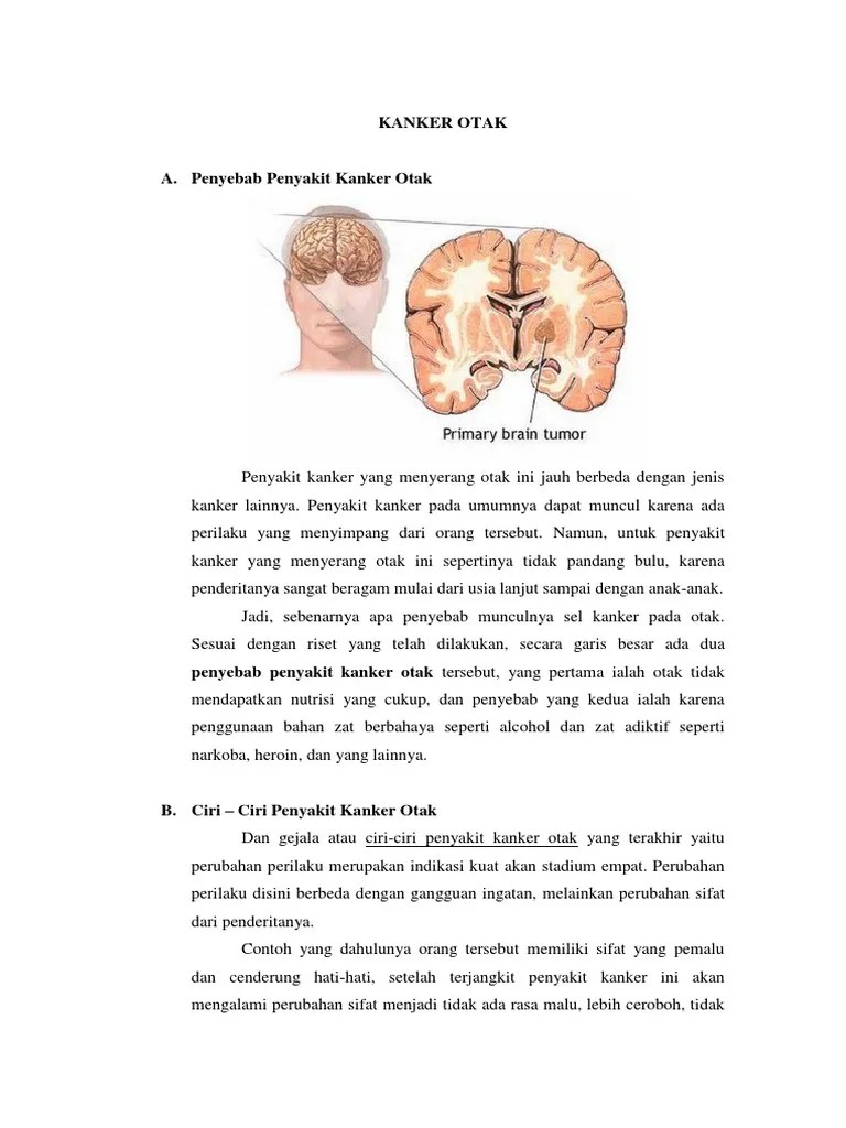 Ciri Ciri Kanker Otak Dan Penyebabnya Ini Cirinya