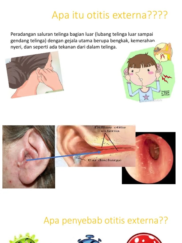 Apa Itu Otitis Externa