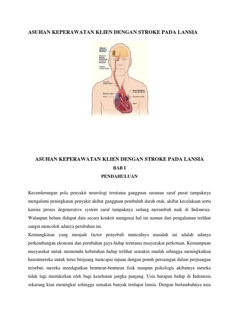 Asuhan Keperawatan Klien Dengan Stroke Pada Lansia