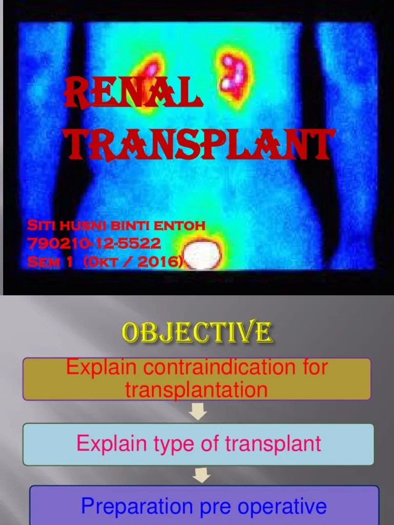 PostRenal Transplant Care A Case Study on the Management of a Young