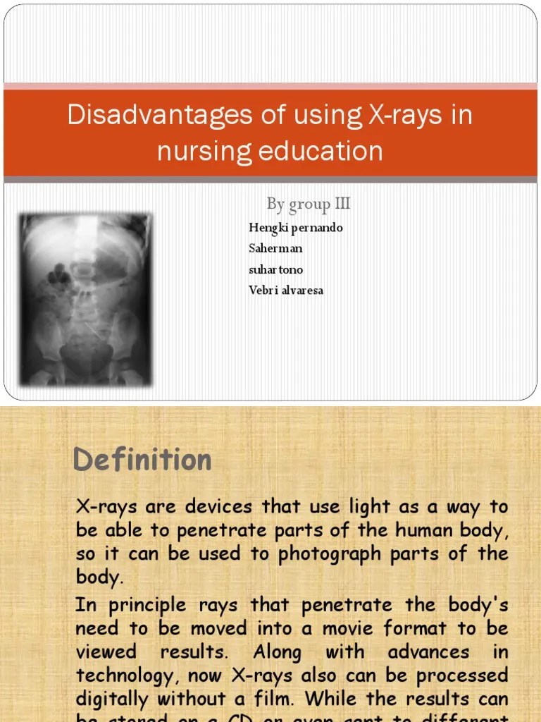 Disadvantages of Using Xrays in Nursing Education X Ray Health