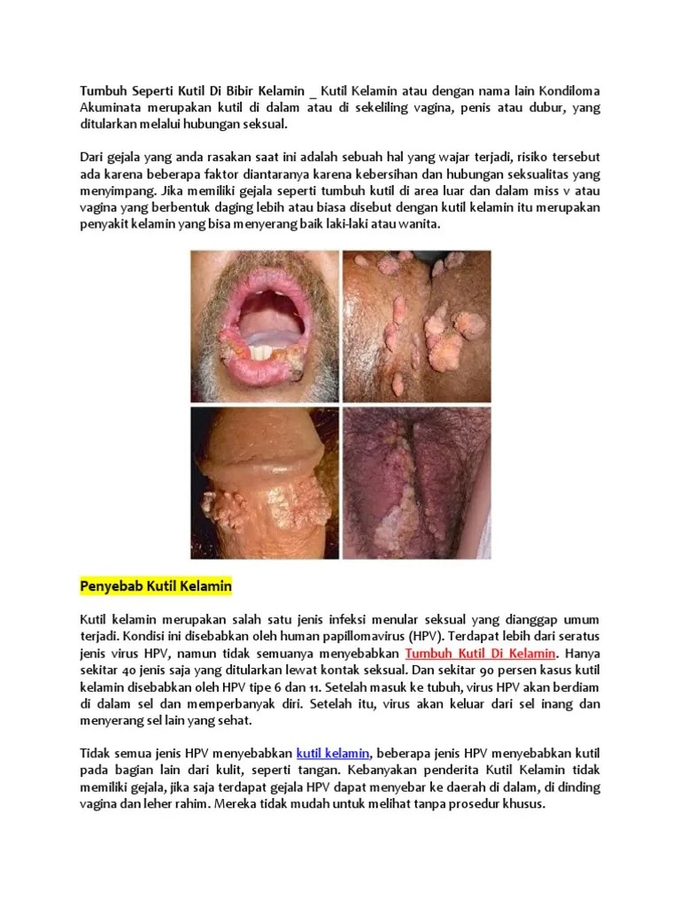 Tumbuh Seperti Kutil Di Bibir Kelamin | PDF