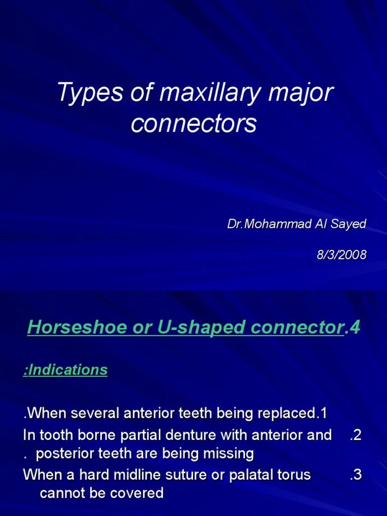 Types of Maxillary Major Connectors PDF Dentures Health Sciences