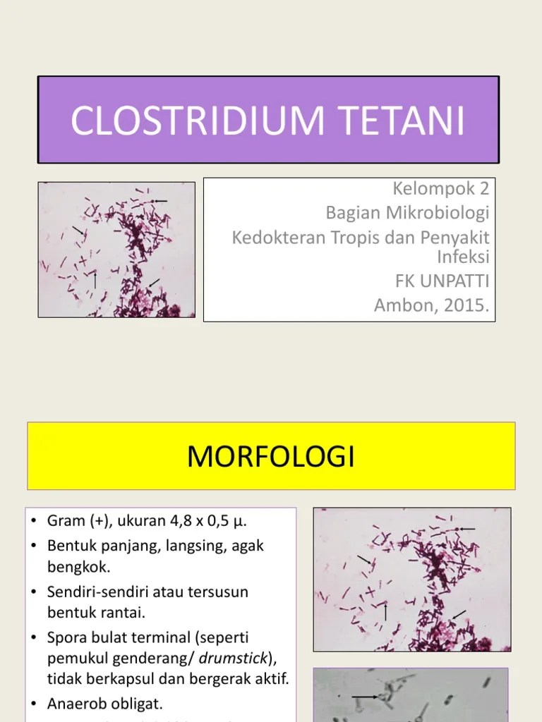 Kelompok 2 Clostridium Tetani 1 | PDF
