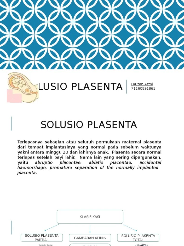 SOLUSIO PLASENTA