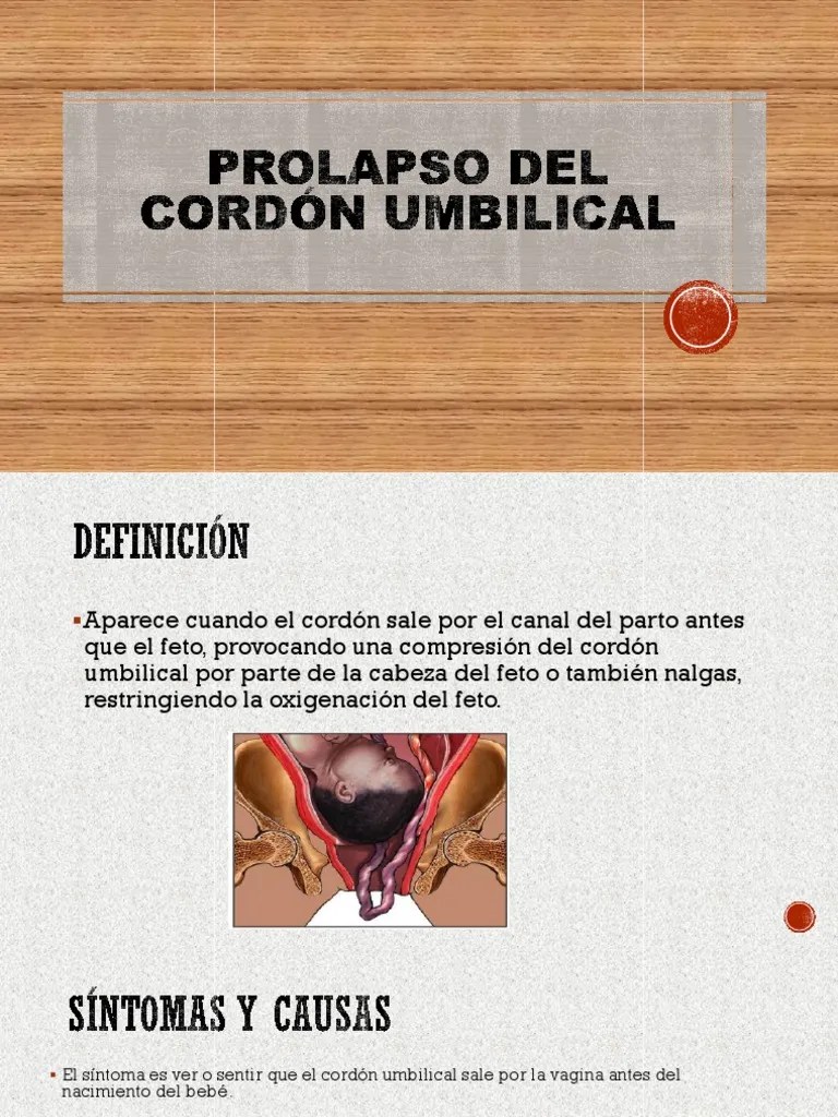 Prolapso Del Cordón Umbilical Feto Parto