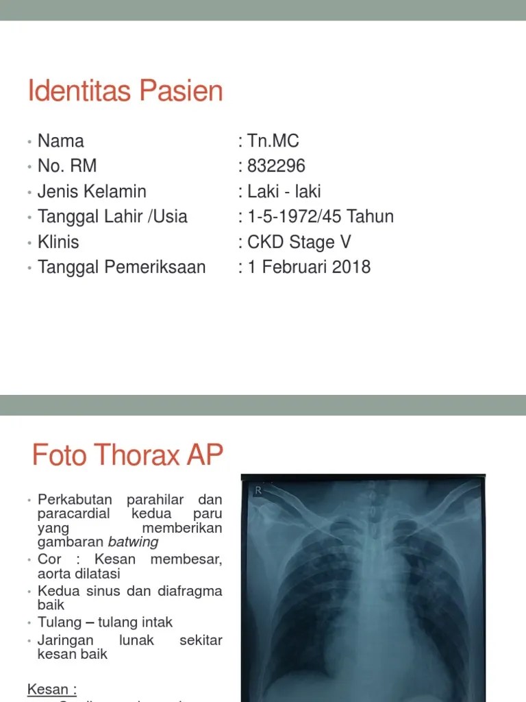 Case Edema Paru Dan Gambaran Radiologi Edema Paru